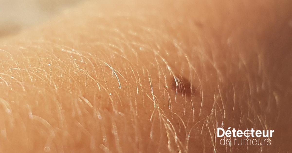 L’être humain n’a plus besoin de poils ? Plutôt vrai Agence Science